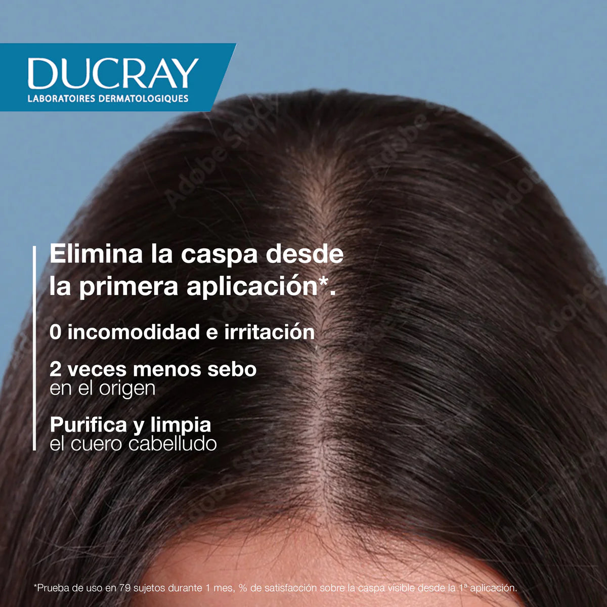 Squanorm Shampoo Caspa Grasa