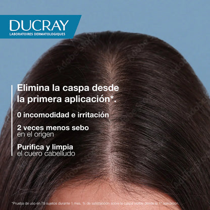 Squanorm Shampoo Caspa Grasa